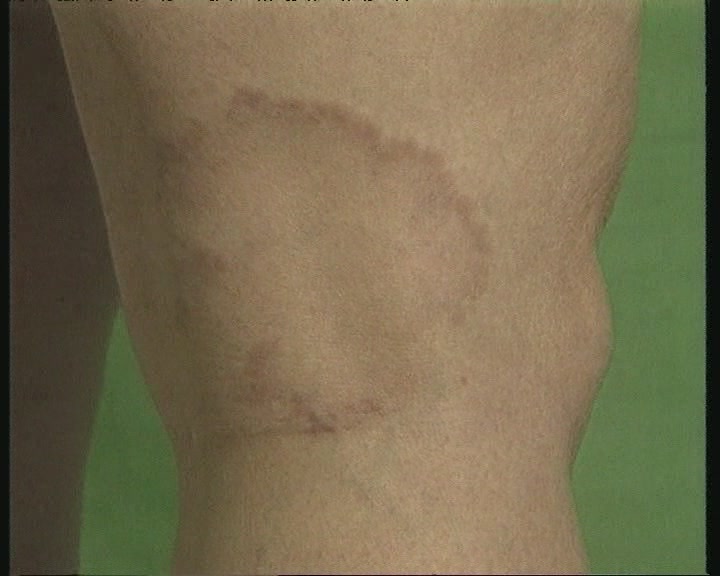 Krizantém: ha ezekre figyelsz, tele lesz virággal