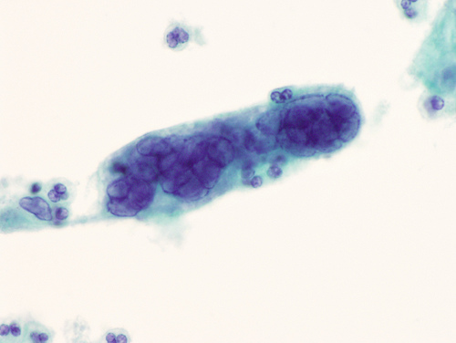 Krizantém: ha ezekre figyelsz, tele lesz virággal