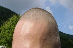 Egy hajszálon múlik a férfiasság?