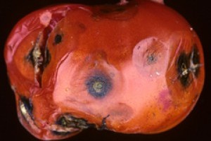 A paradicsom kolletotrichumos bogyófoltossága