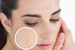 Hogyan kezelhető a vízhiányos bőr?