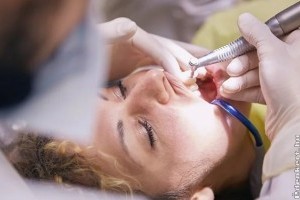 A szájápolás az időszakos fogkő-eltávolítással lehet teljes