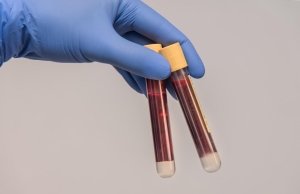 Plazmaadás: életmentő segítség mindenkinek